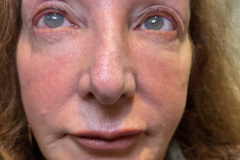 Photo-Apr-23-2025-11-00-39-AM